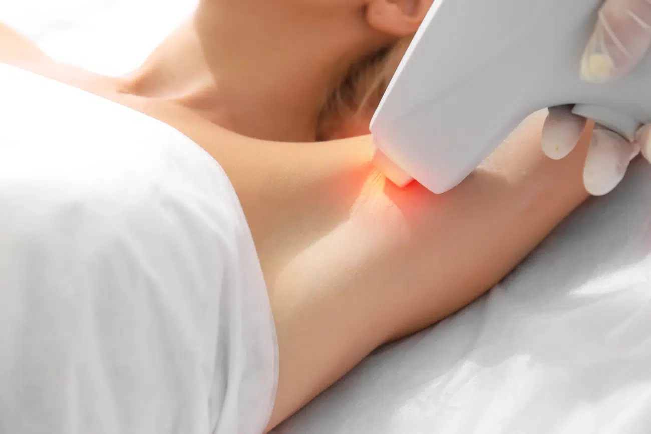 Épilation laser à Maxeville